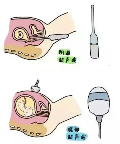 广州代孕助孕服务机构|试管知识：杭州三代试管婴儿.