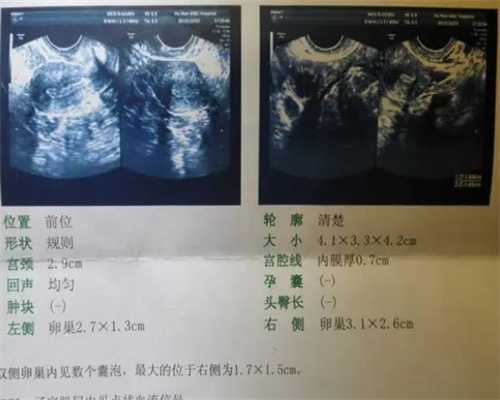 广州在哪里可以找到代孕母|桂林供卵试管婴儿医院排名？
